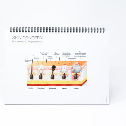 Skin Journey Tent Card
